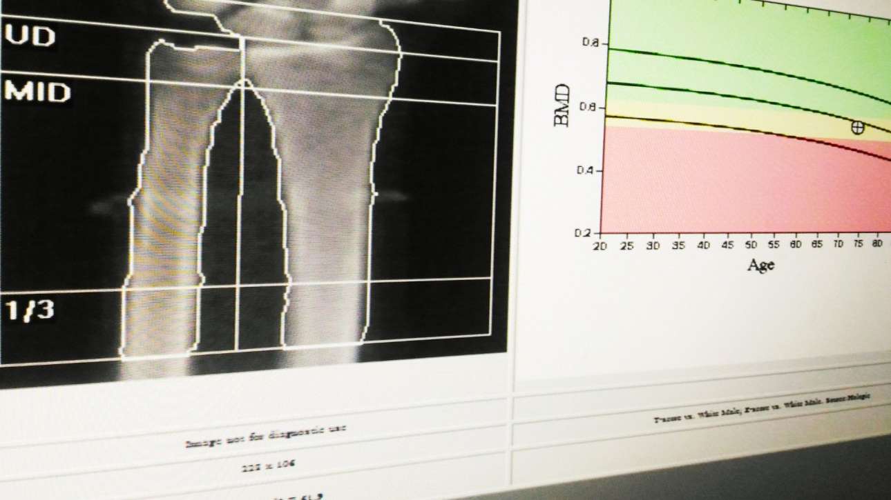 MOC DEXA Catanzaro